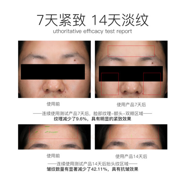 4 紅花械緊塑撫紋系列